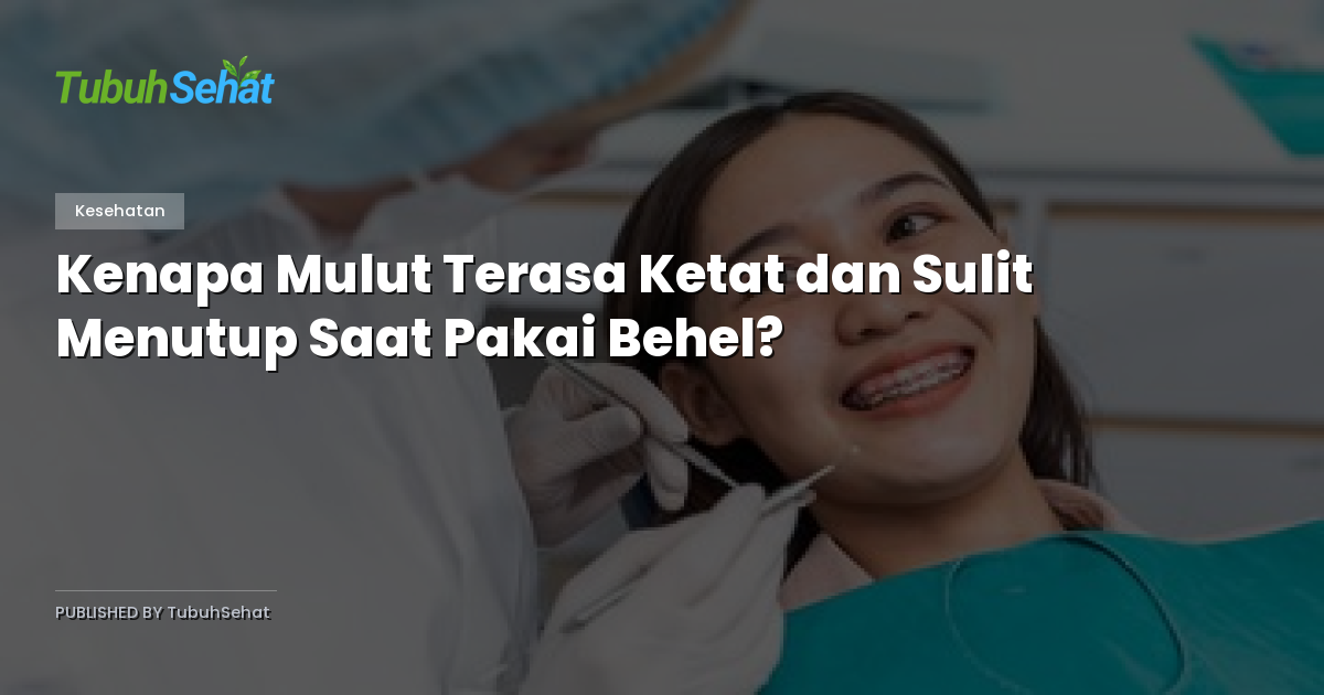Kenapa Mulut Terasa Ketat dan Sulit Menutup Saat Pakai Behel?