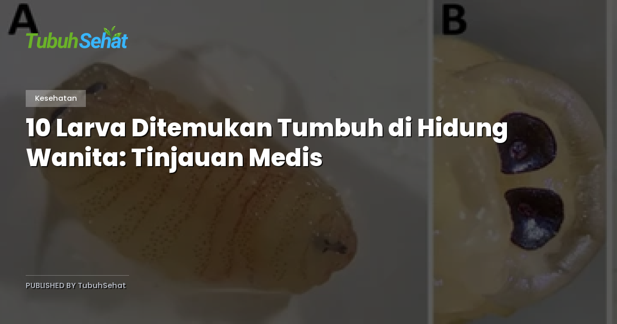 10 Larva Ditemukan Tumbuh di Hidung Wanita: Tinjauan Medis
