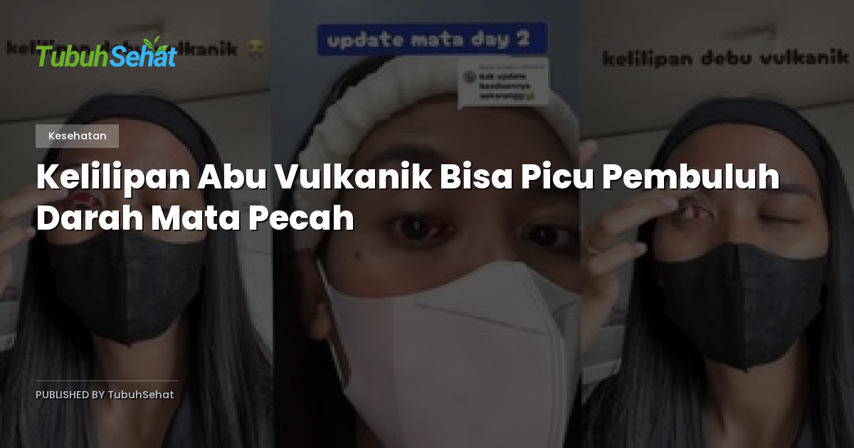 Kelilipan Abu Vulkanik Bisa Picu Pembuluh Darah Mata Pecah